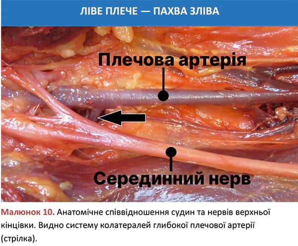 Анатомічне співвідношення судин та нервів верхньої кінцівки