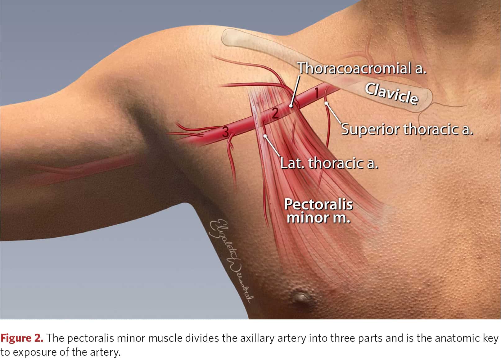 Anatomy of the pectoralis minor muscle and axillary artery