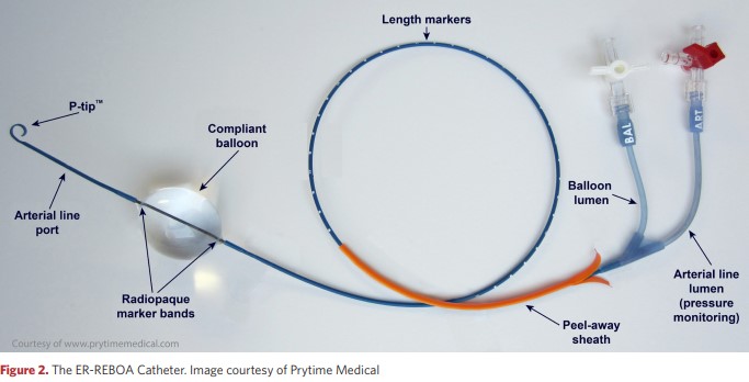 The ER-REBOA Catheter