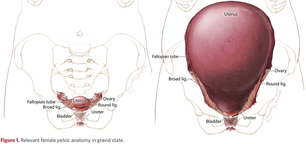 Relevant female pelvic anatomy in gravid state