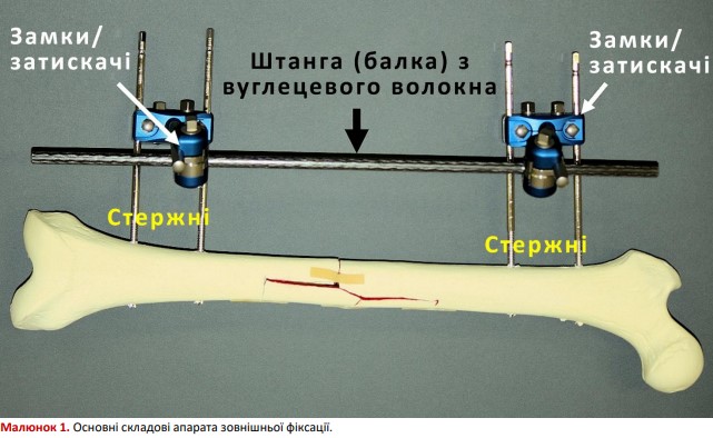 Основні складові апарата зовнішньої фіксації