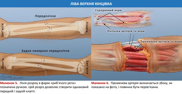 Променева артерія