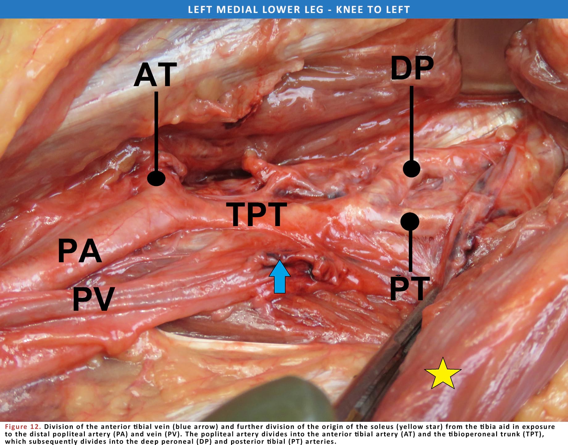 Left Medial Lower Leg - Knee To Left