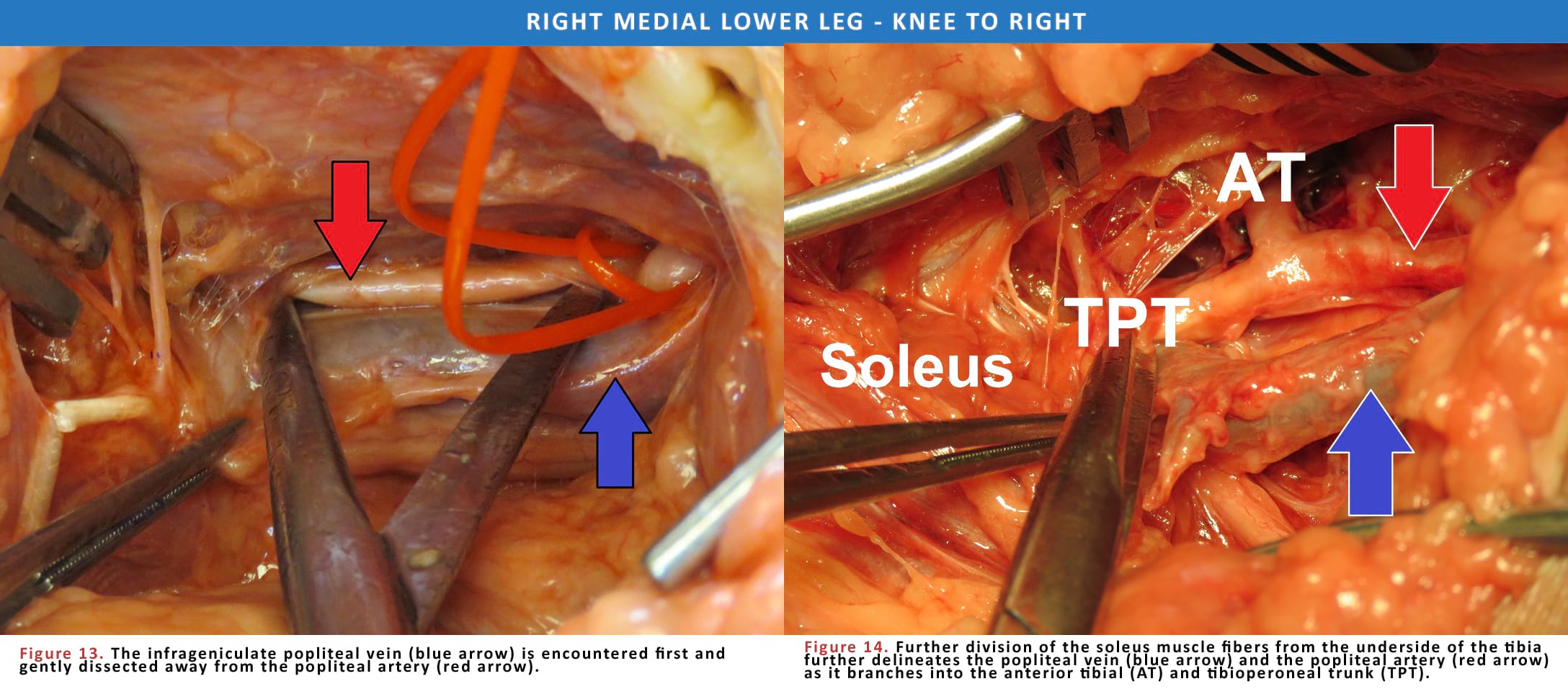 Right Medial Lower Leg - Knee To Right