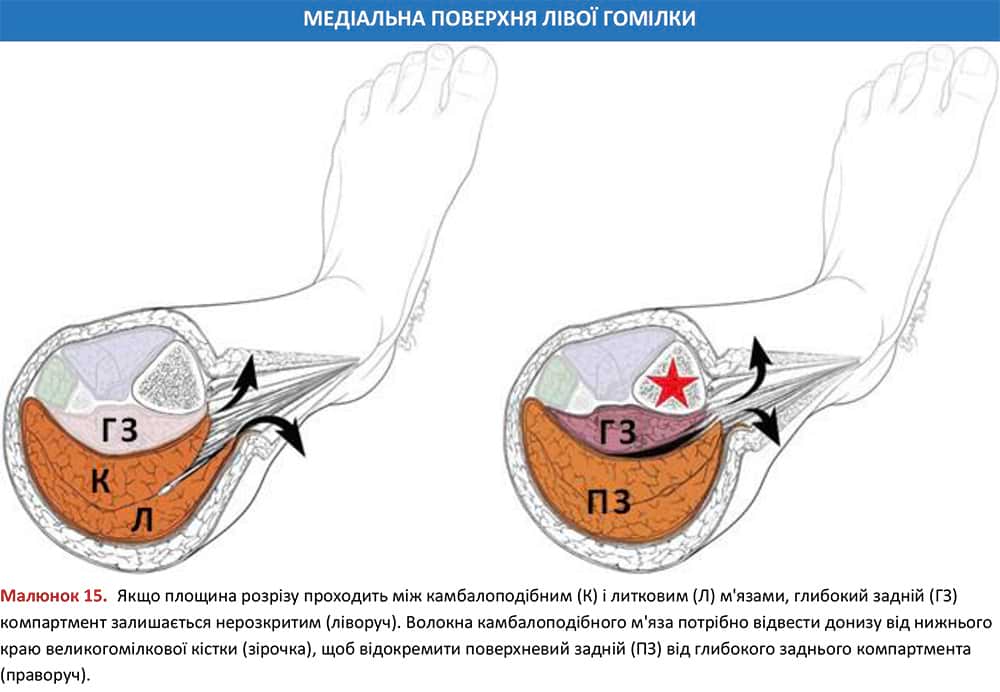 Анатомія компартментментів поверхні лівої гомілки