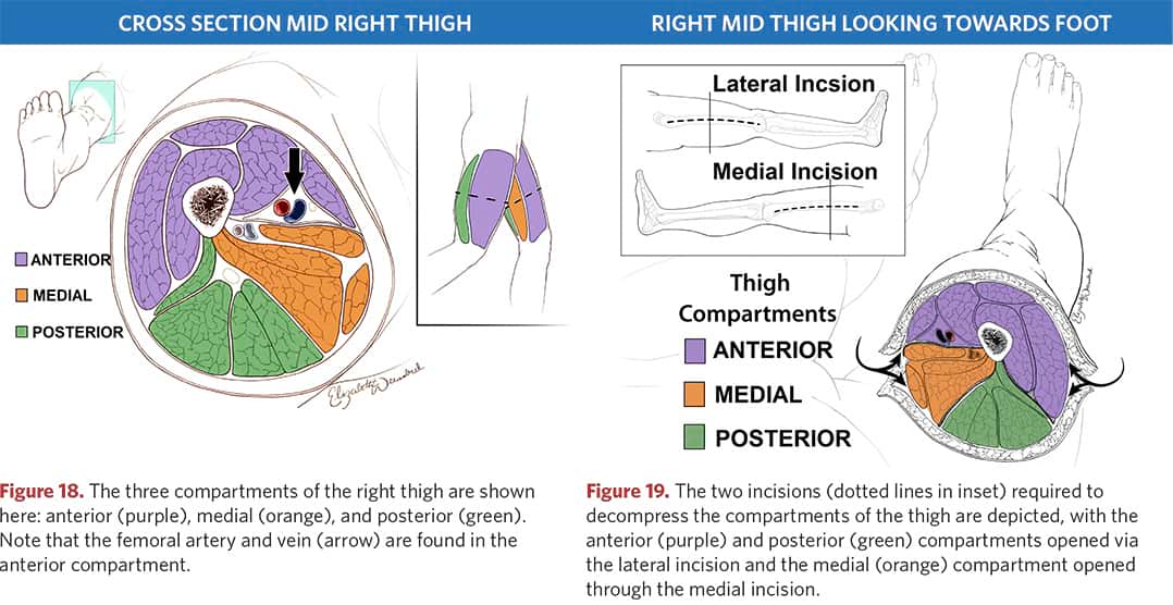 The three compartimenti of the right stem