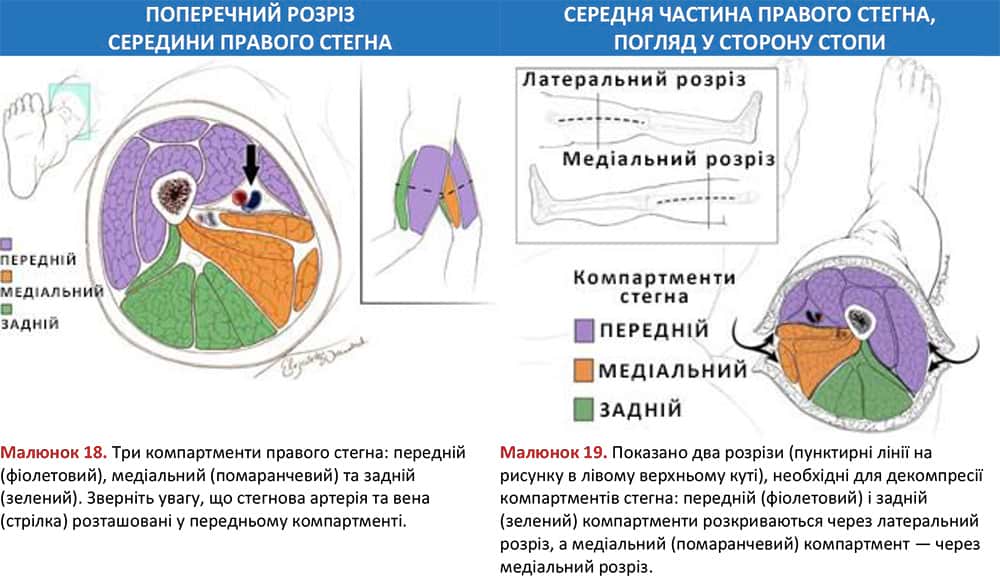 Три компартменти правого стегна