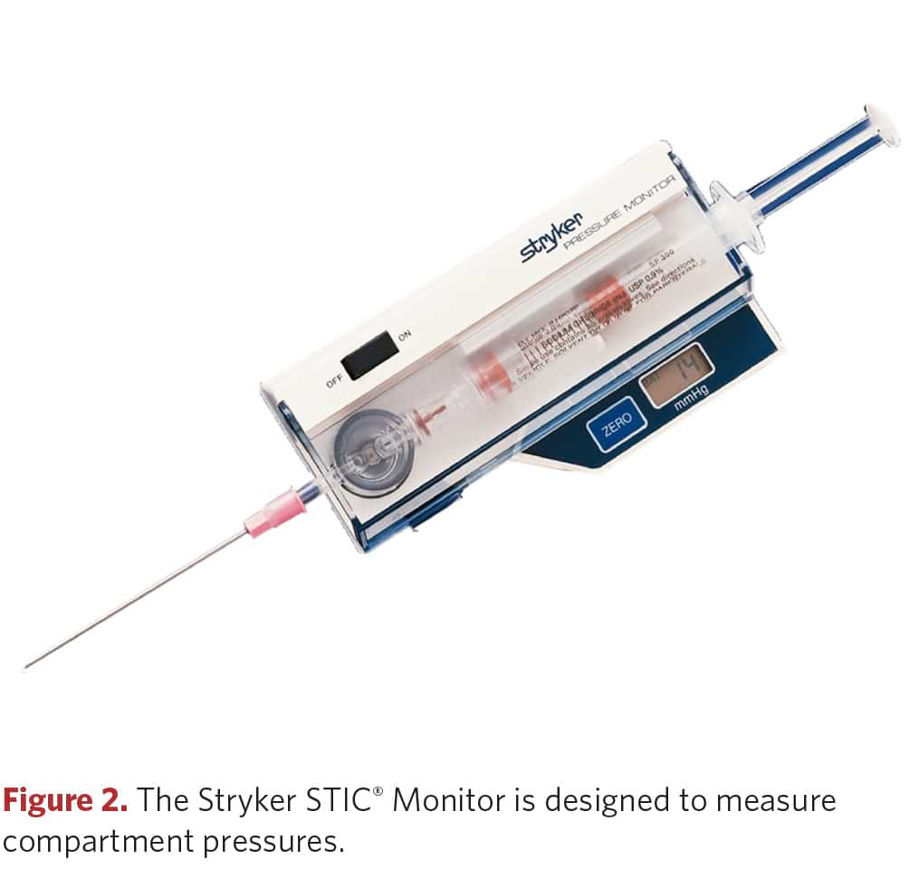 The Stryker STIC Monitor