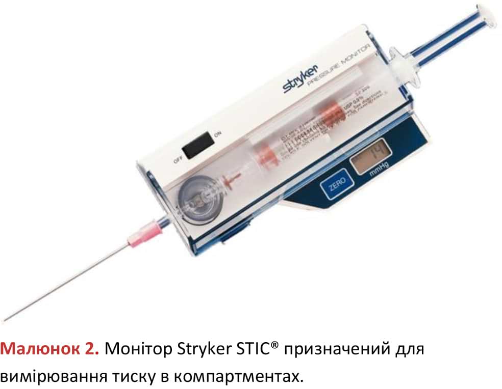 Монітор Stryker STIC