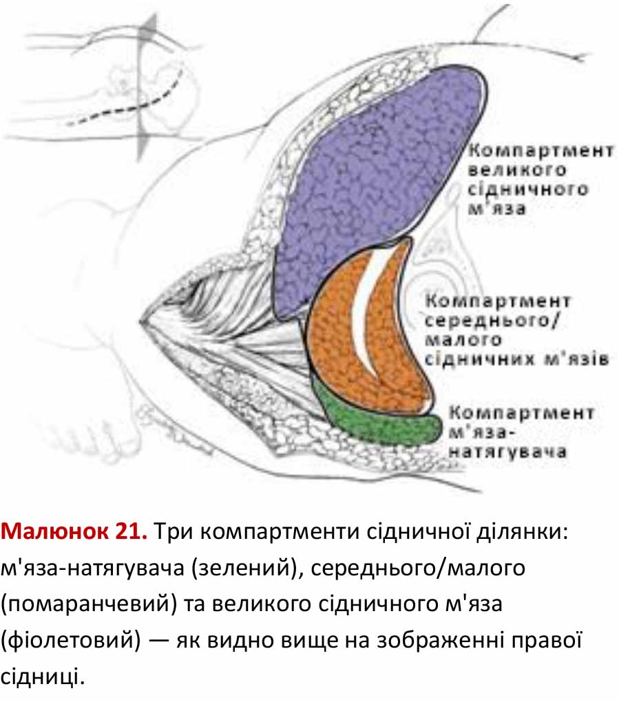 Три компартменти сідничної ділянки