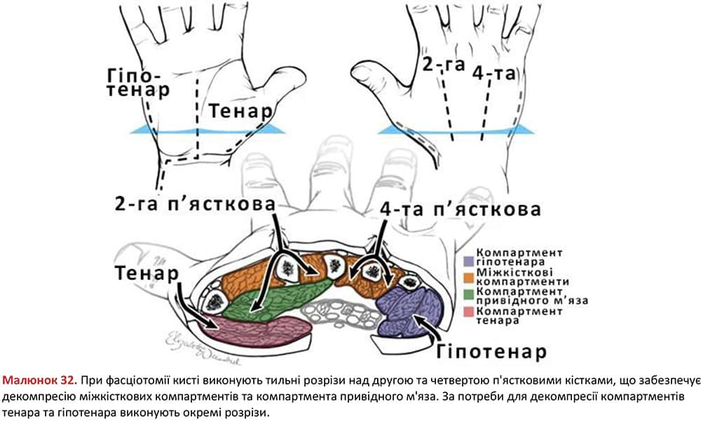 Фасціотомія кисті - анатомія