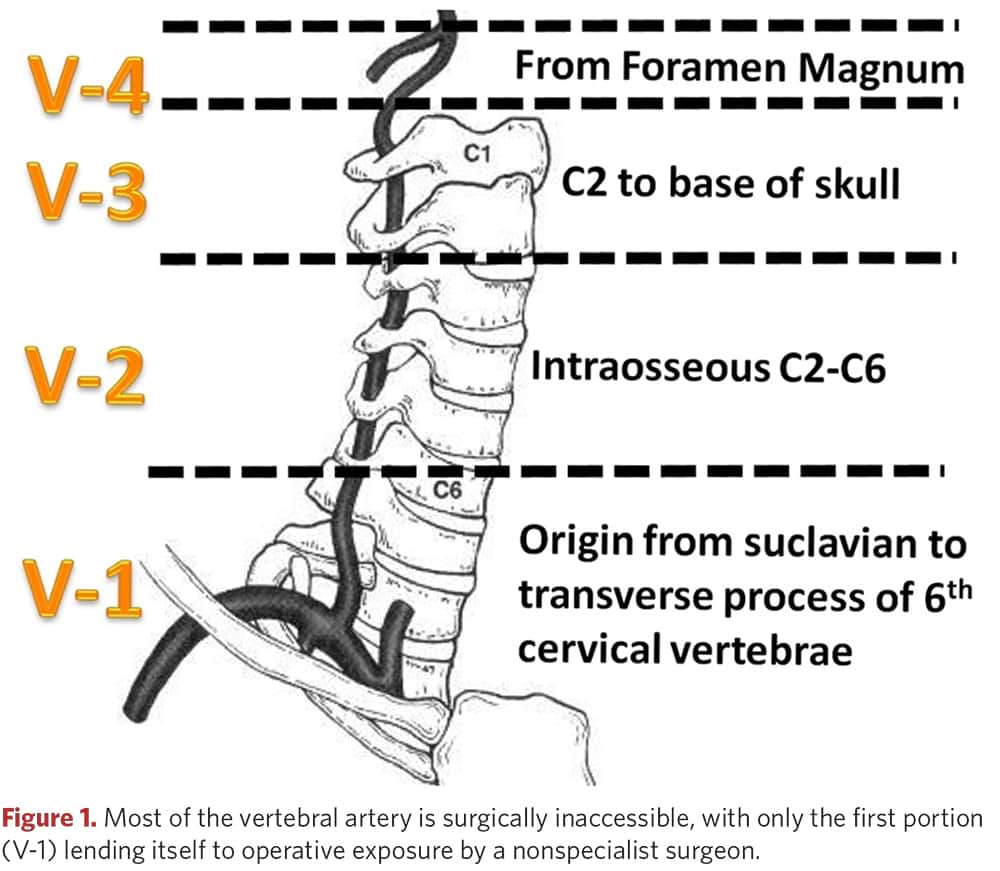 Anatomy of the vertebral artery