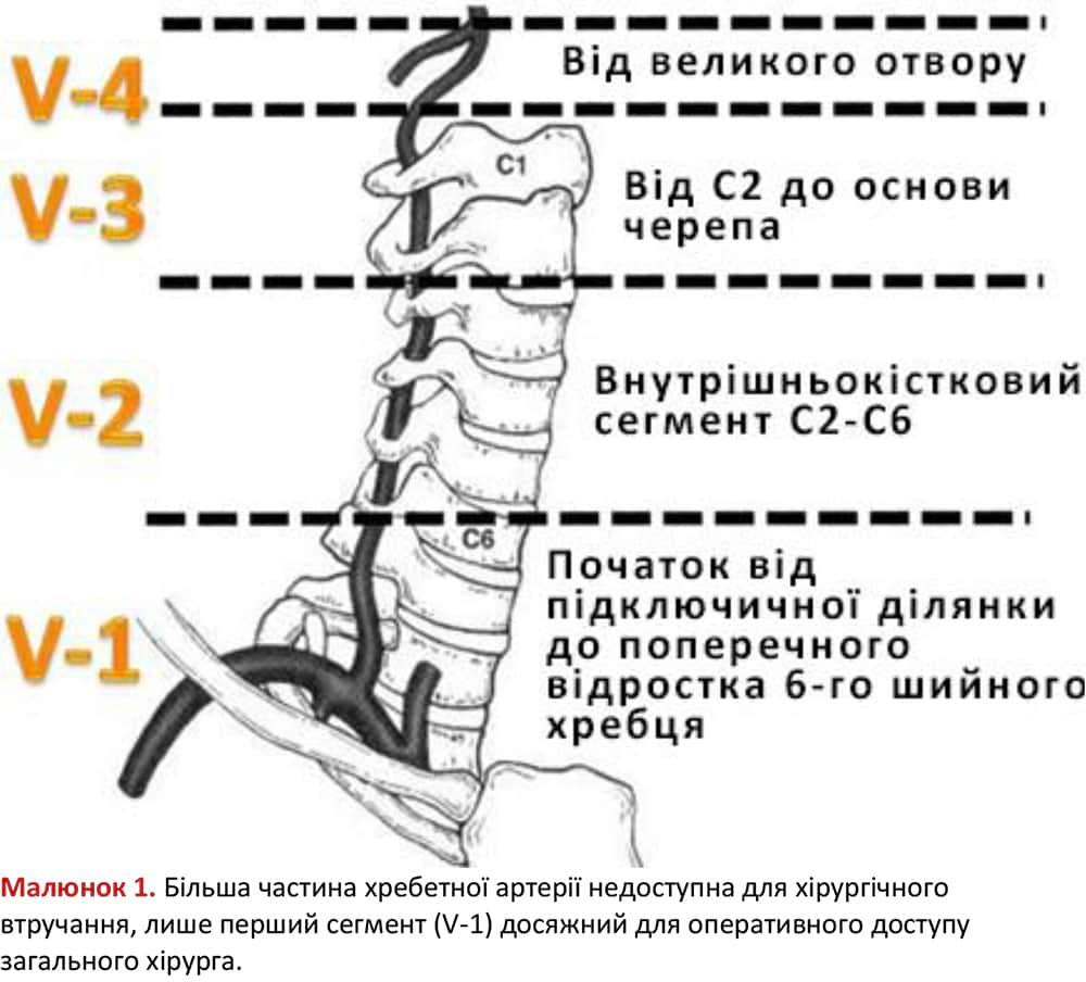 Анатомія хребетної артерії