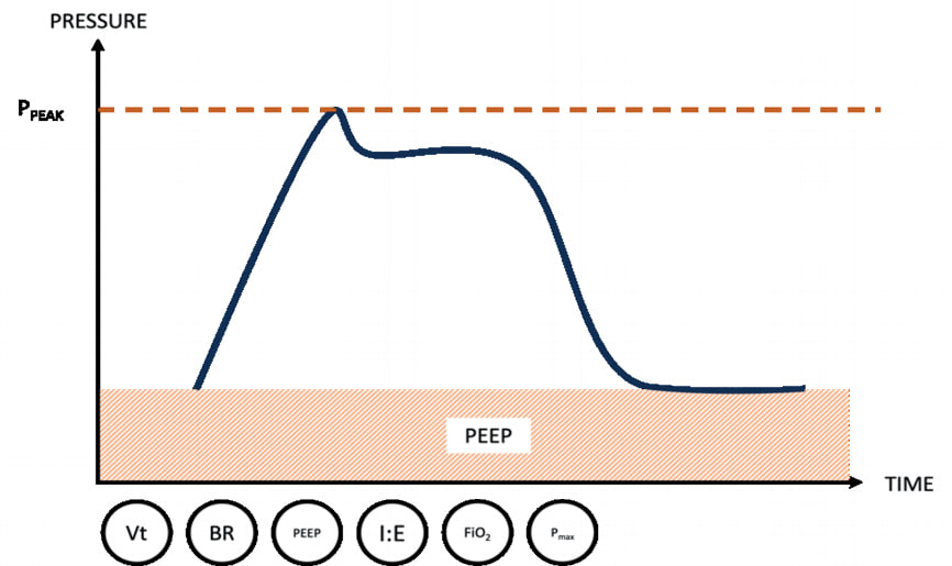 Вентиляція з керованим об&rsquo;ємом (VCV) - графік