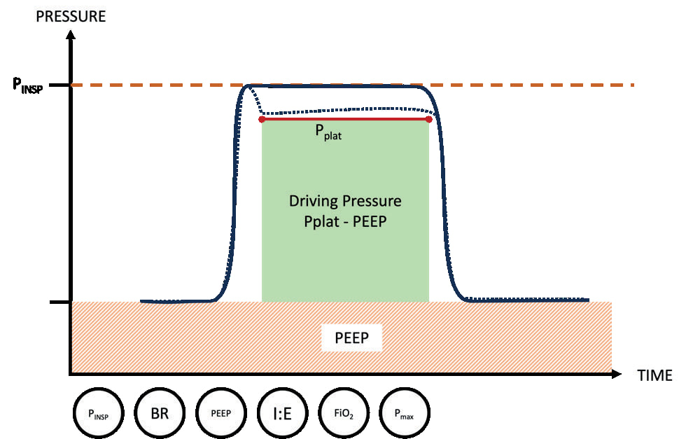Вентиляція з керованим тиском (PCV)