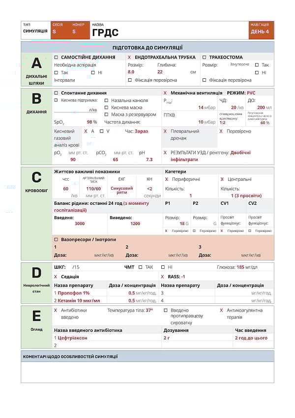 Симуляція S5: ГРДС - 2