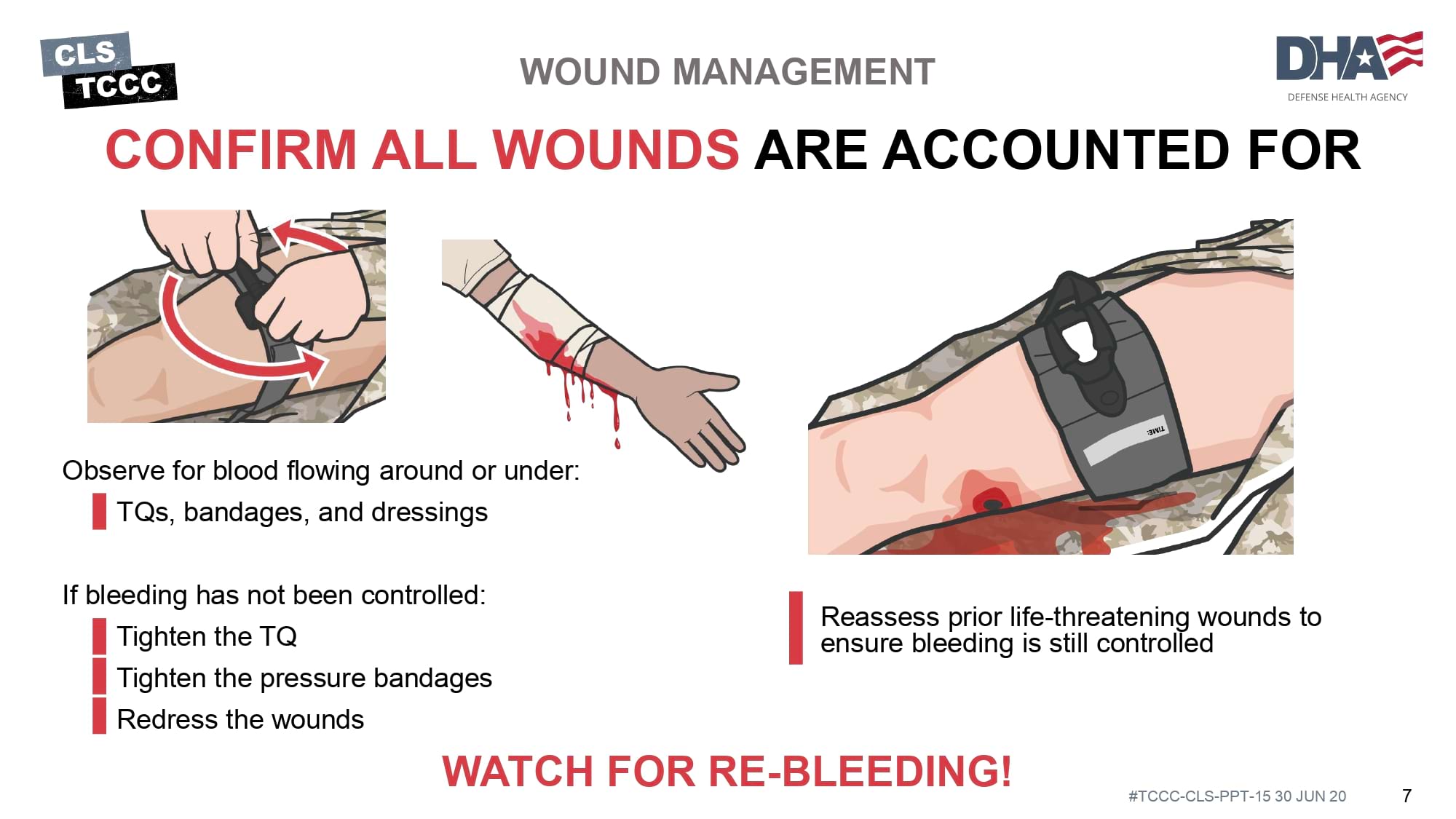 module-15-wound-management-slide-07