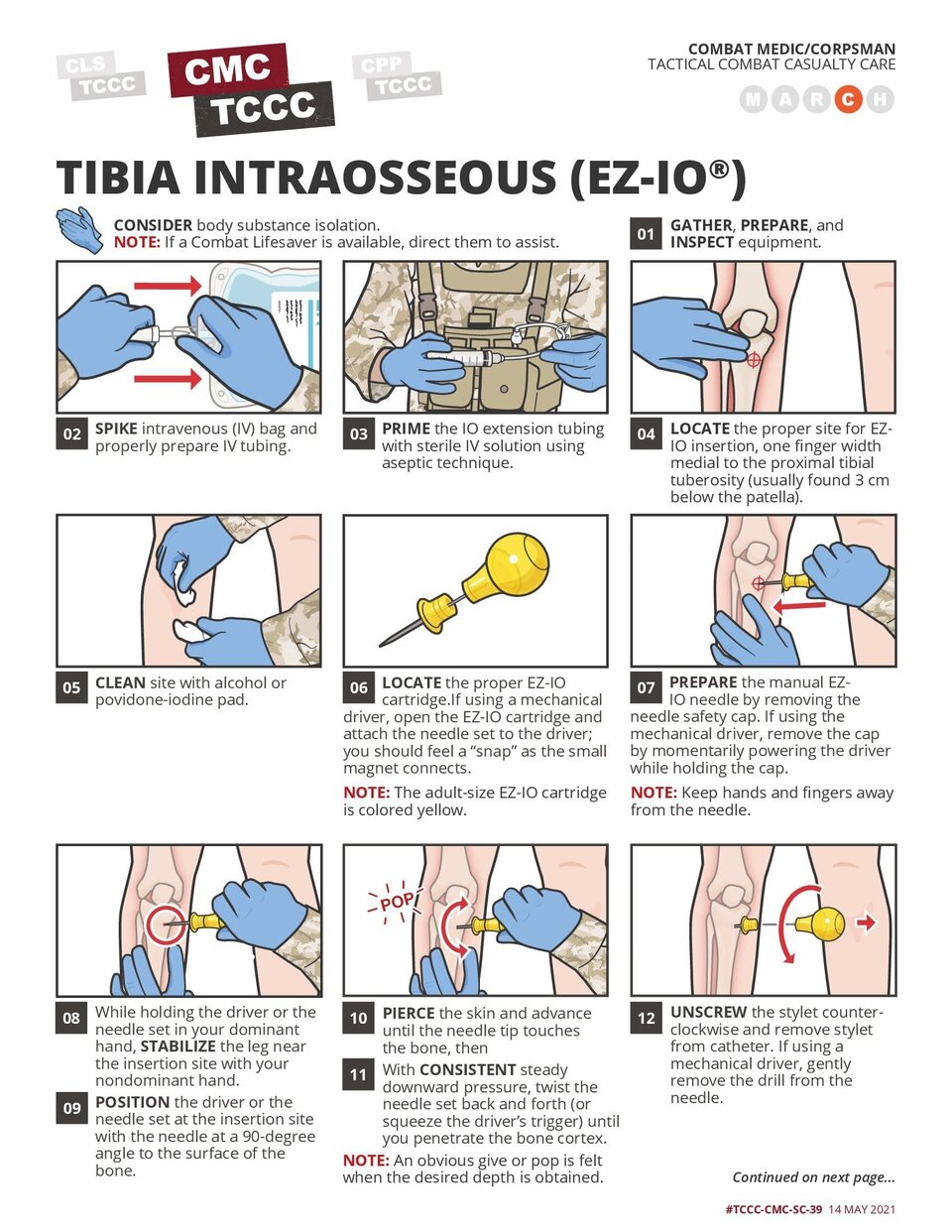 EZ-IO Tibial Intraosseous Access