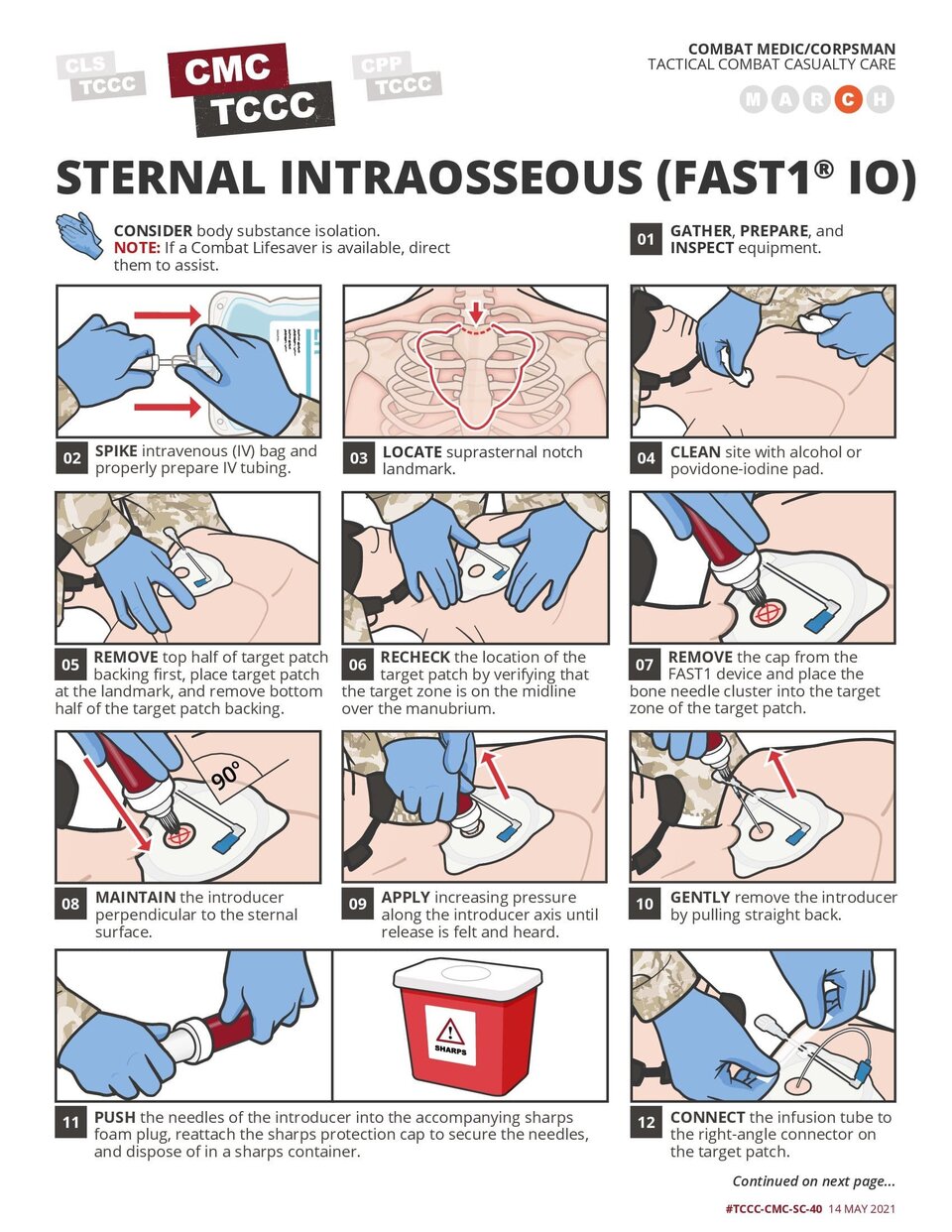 FAST1 Intraosseous Access