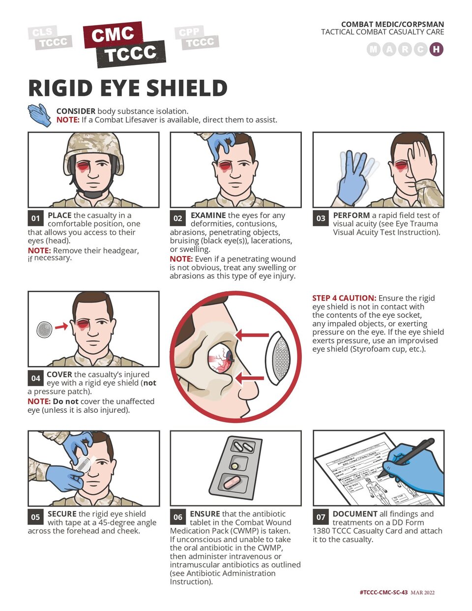 Application of a Rigid Eye Shield