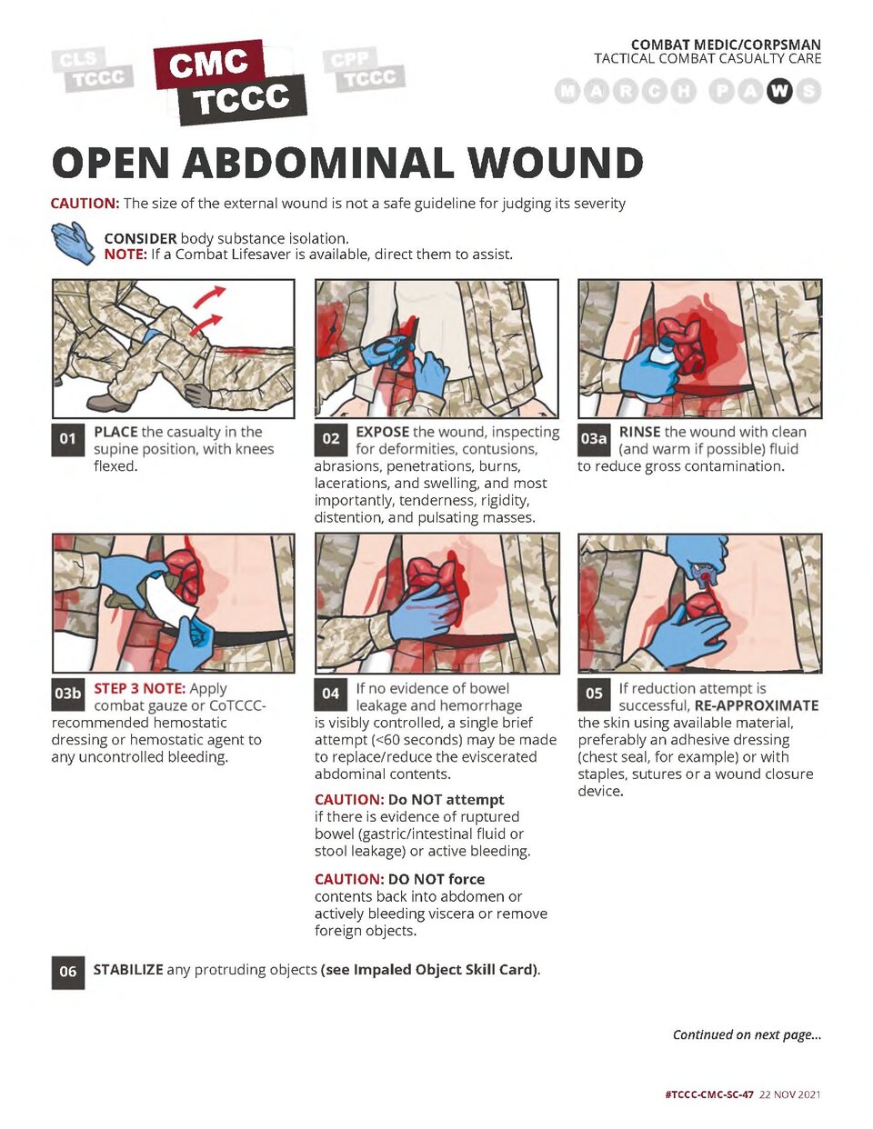 Open Abdominal Wound Dressings