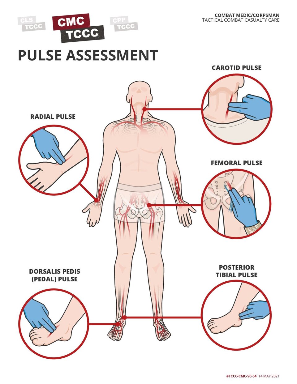 Pulse Assessments