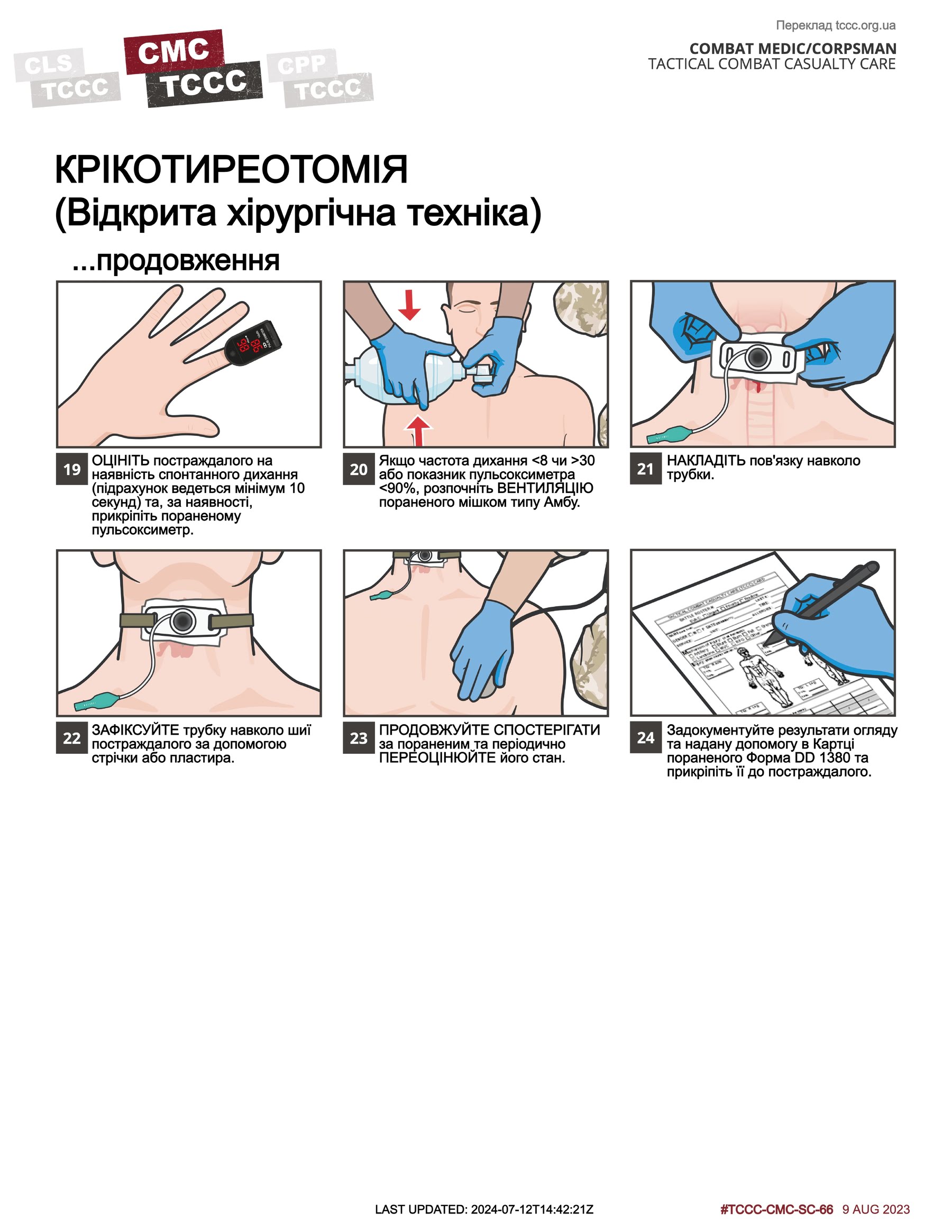 Крікотиреотомія (відкрита хірургічна техніка), cmc, сторінка 3