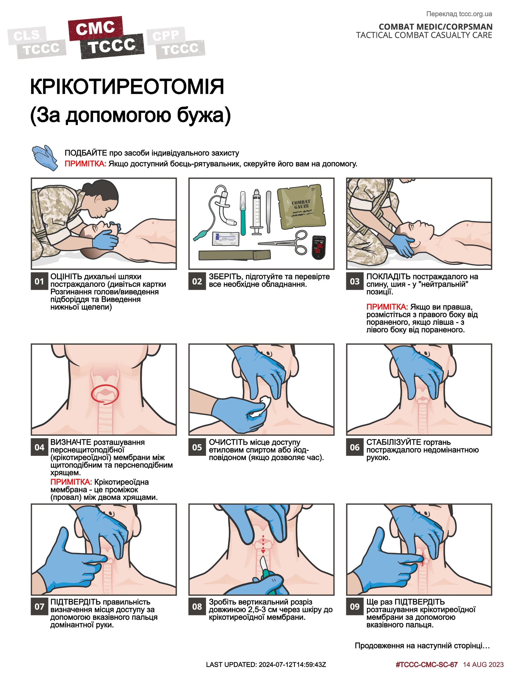 Крікотиреотомія (за допомогою бужа), cmc, сторінка 1