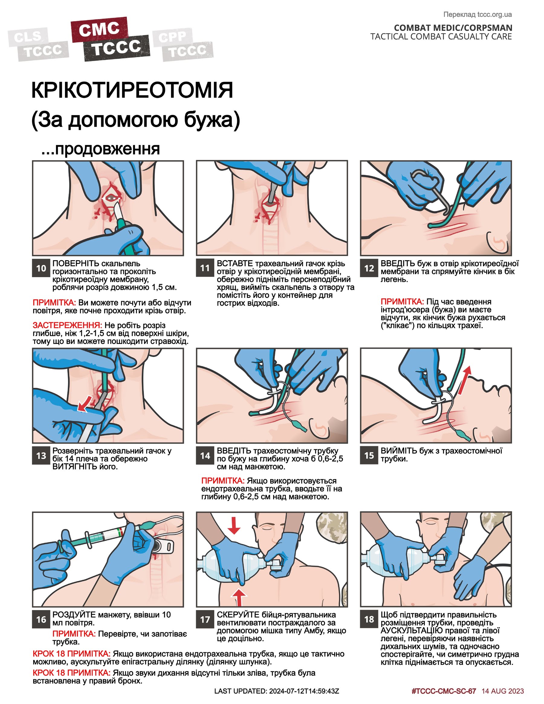 Крікотиреотомія (за допомогою бужа), cmc, сторінка 2