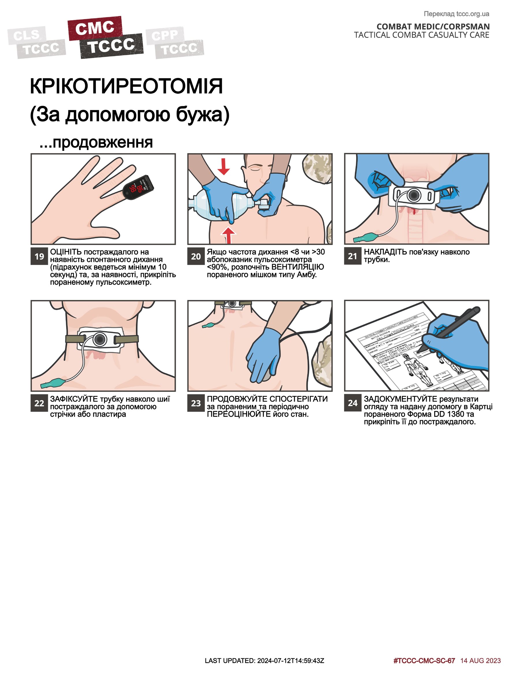 Крікотиреотомія (за допомогою бужа), cmc, сторінка 3