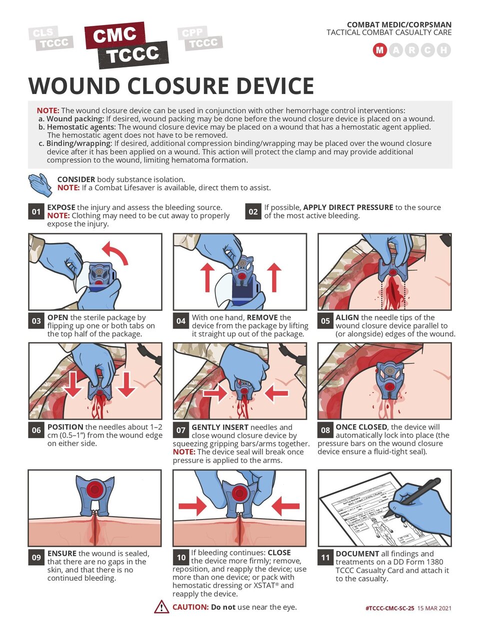 Wound closure device