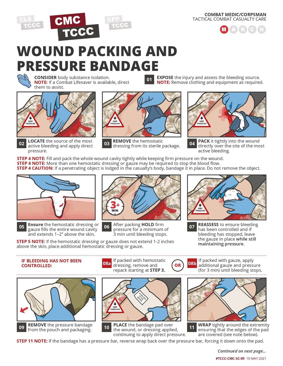 Wound Packing with Hemostatic Gauze and Pressure Bandage