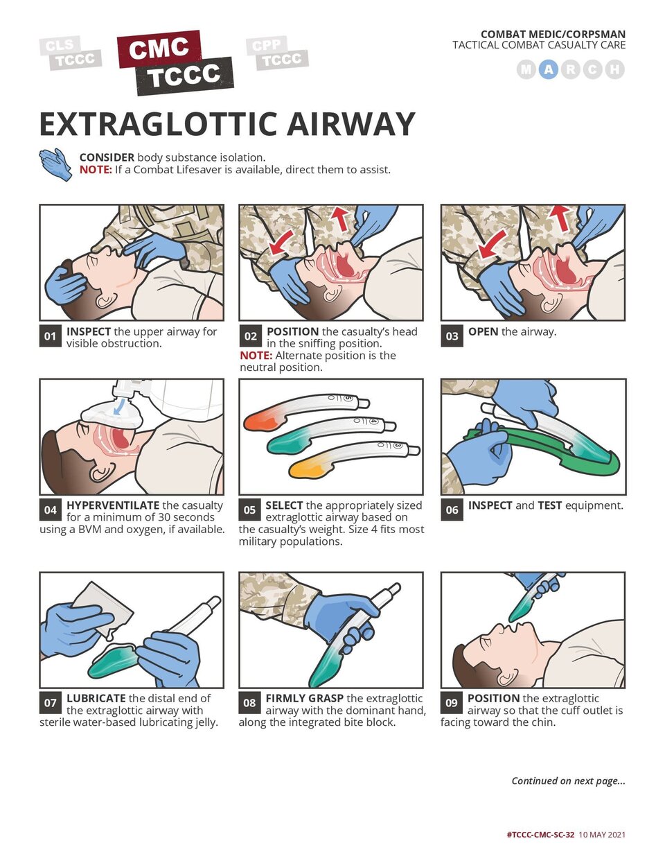 Airway Management in TFC