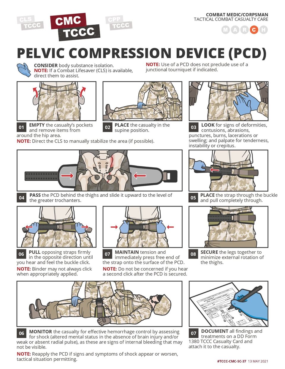 Pelvic Compression Device (PCD)
