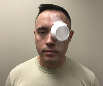Eye shield made of paper or plastic cup
