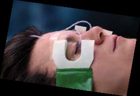 Step 5. Adjust fluid flow, tape lines to forehead of patient, place fluid collection equipment