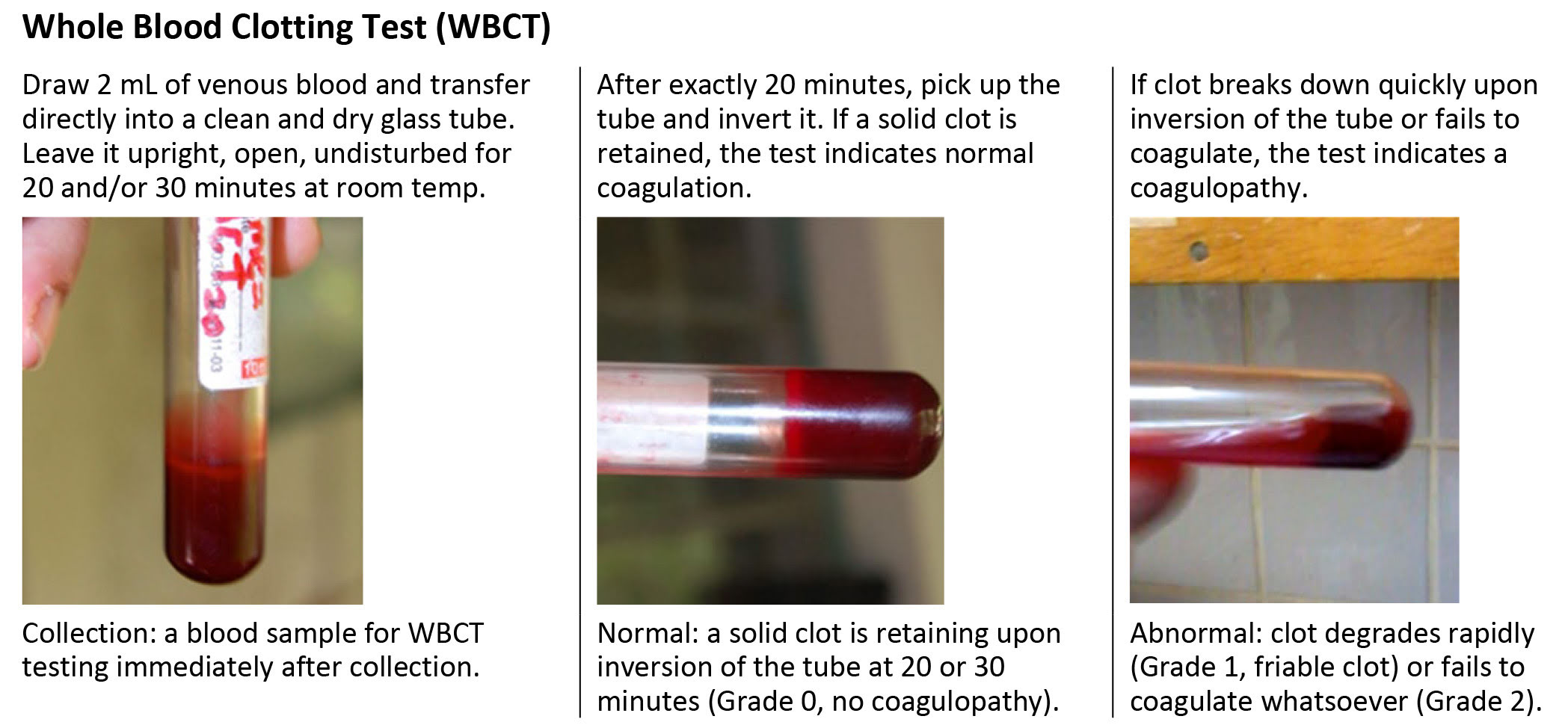 Whole Blood Clotting Test (WBCT)