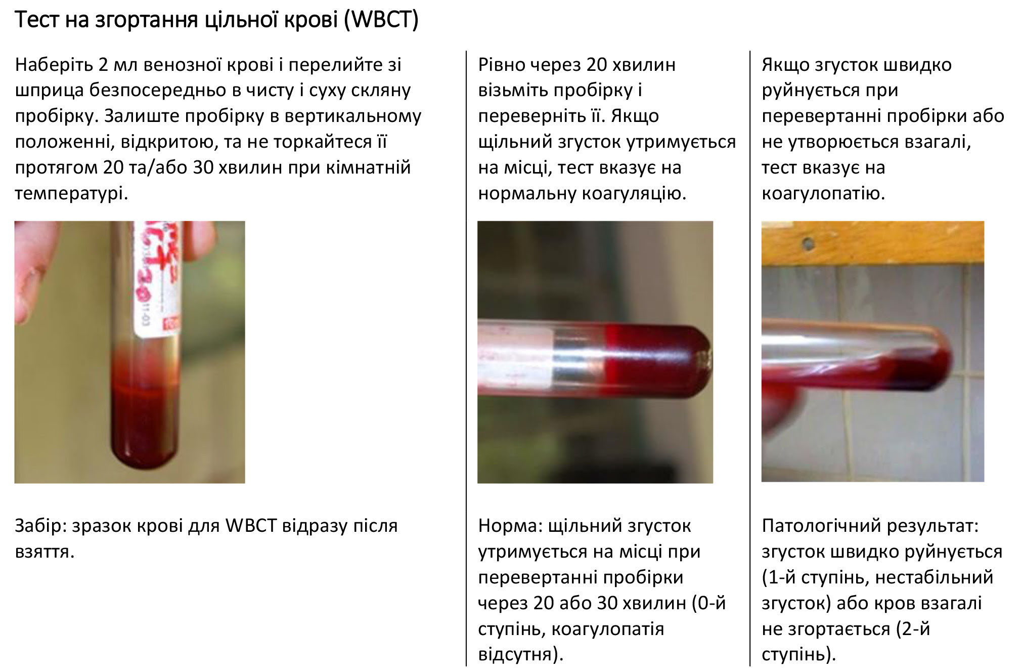Тест на згортання цільної крові (WBCT)