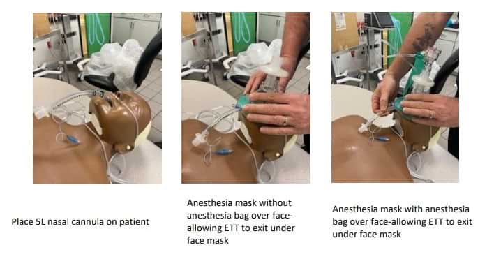Protocol for extubation of COVID-19 patients