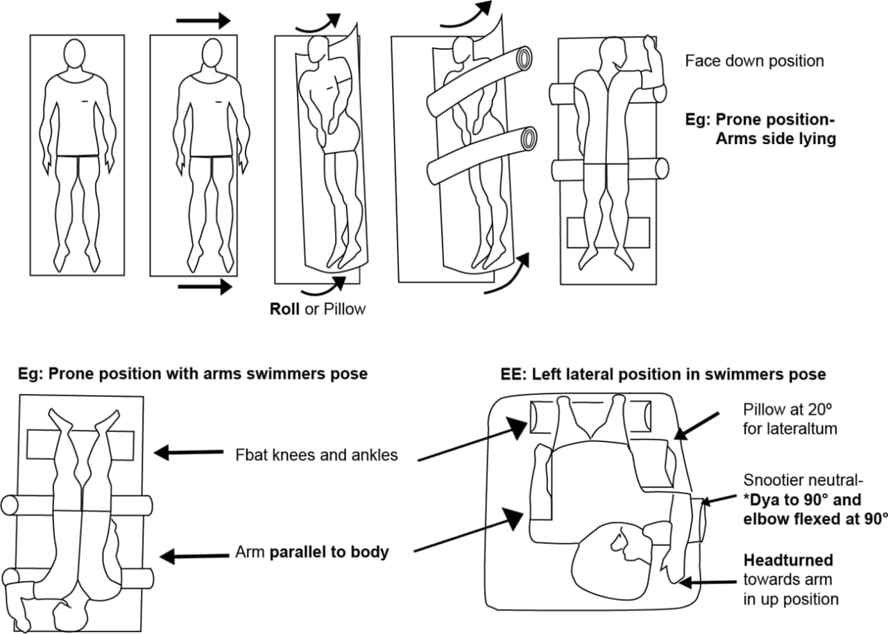 Prone-position: Procedure for proper patient positioning