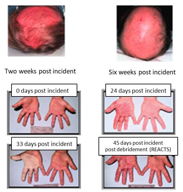 Timeline of CRI