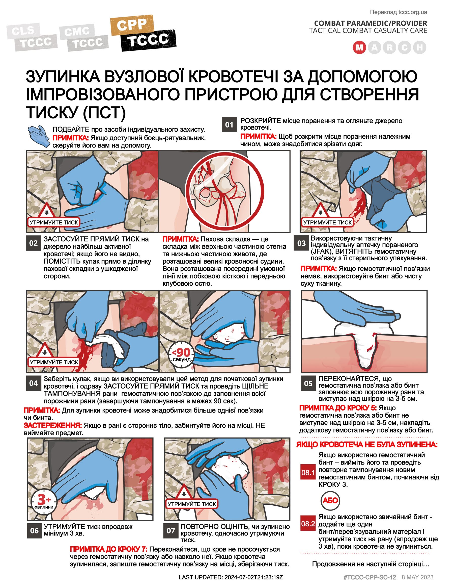 Зупинка вузлової кровотечі за допомогою імповізованого пристрою для створення тиску (ПСТ), cpp, сторінка 1