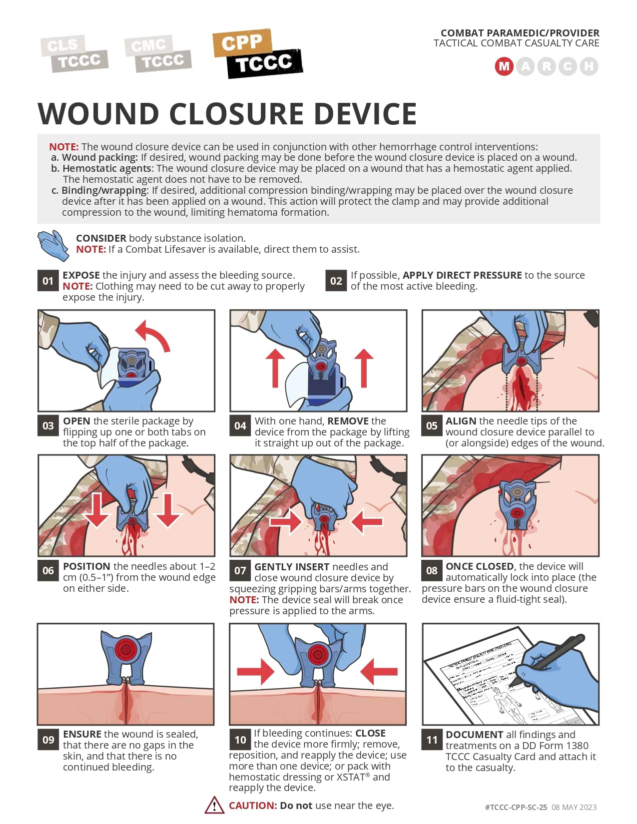 Wound Closure Device, cpp, page 1