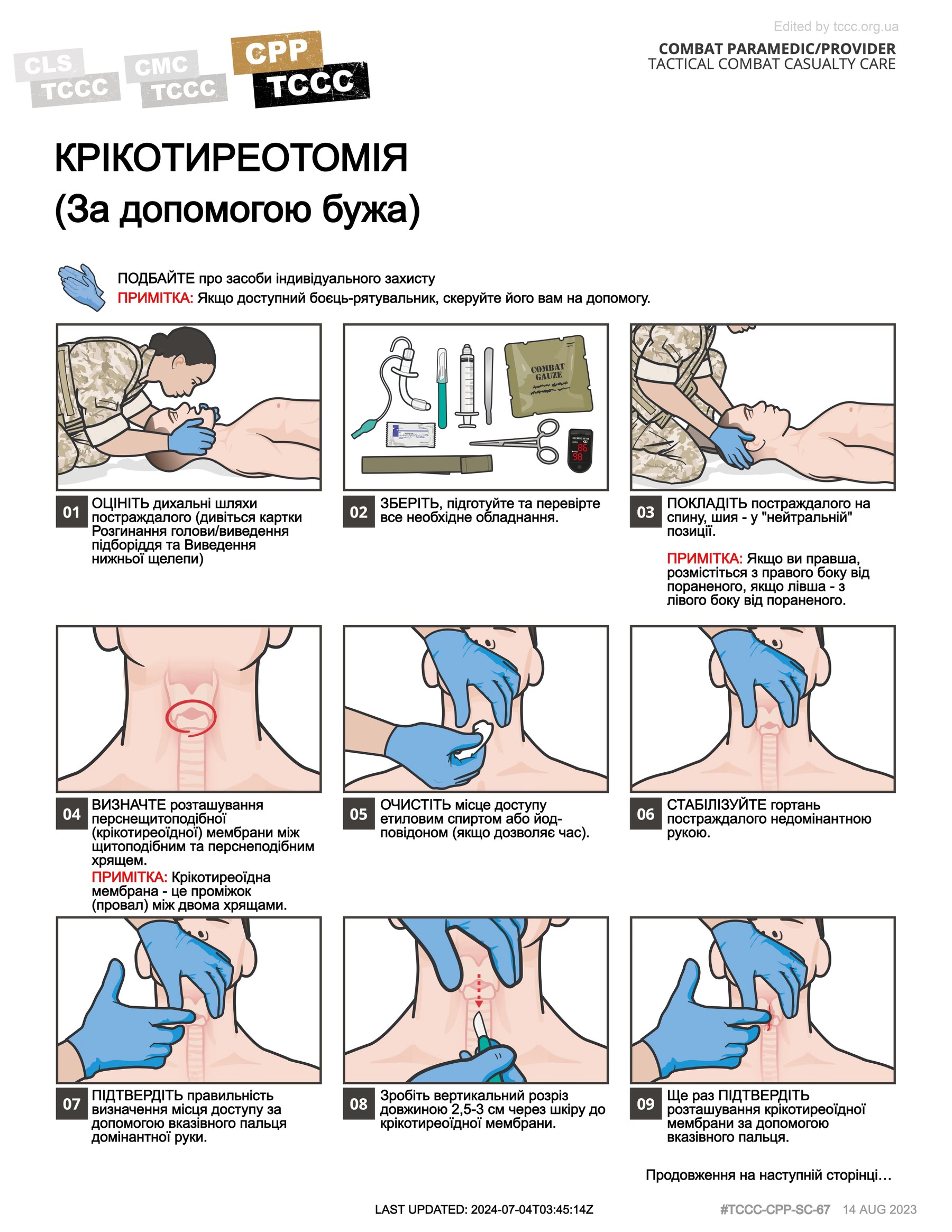 Крікотиреотомія (за допомогою бужа), cpp, сторінка 1