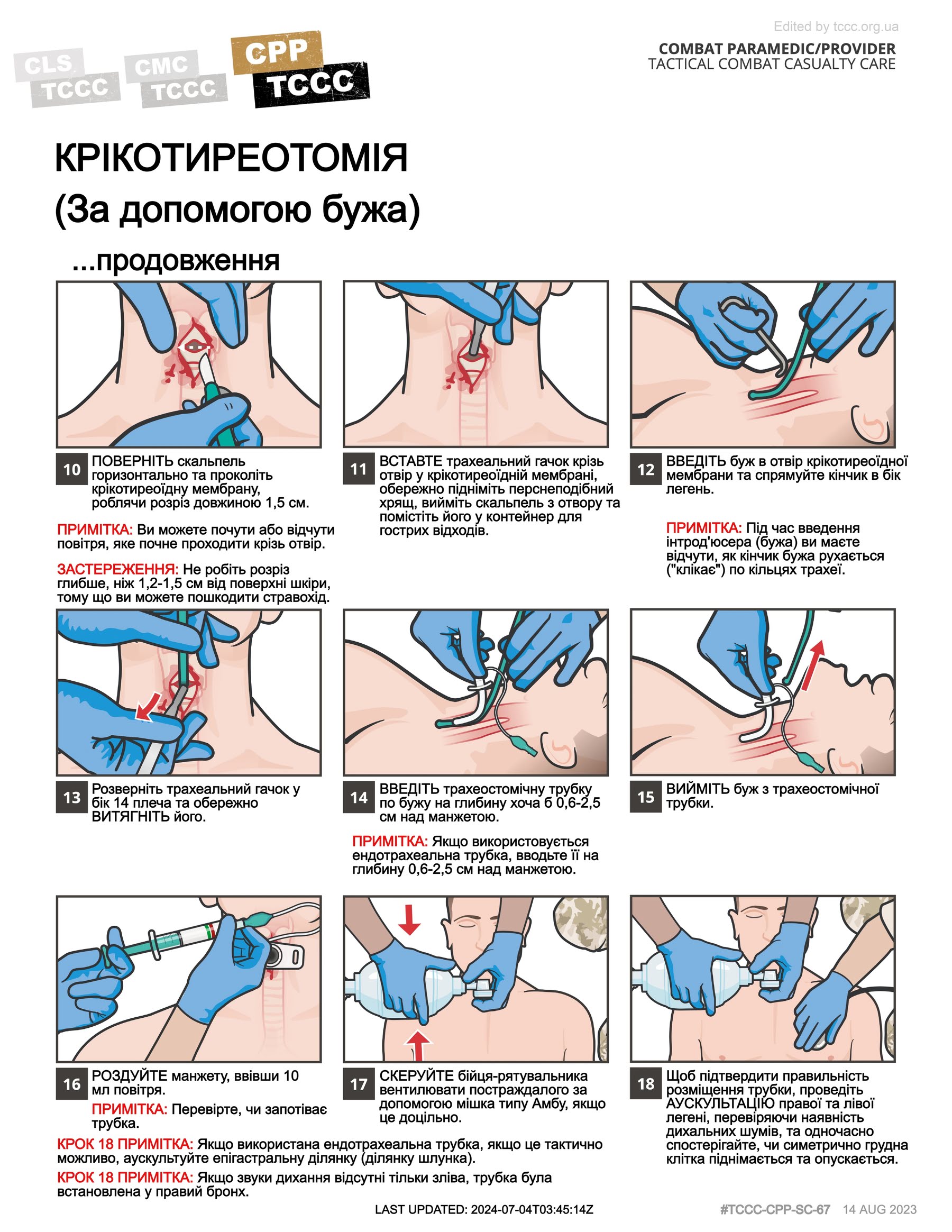 Крікотиреотомія (за допомогою бужа), cpp, сторінка 2