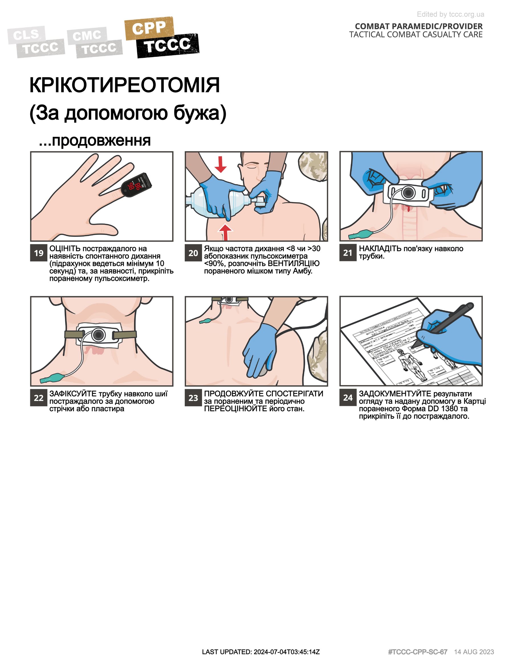 Крікотиреотомія (за допомогою бужа), cpp, сторінка 3