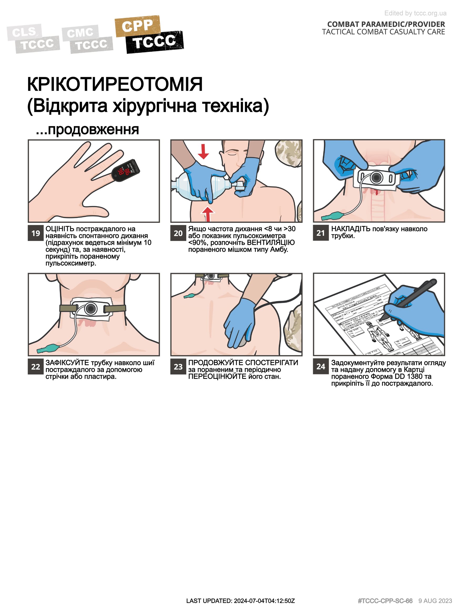 Крікотиреотомія (відкрита хірургічна техніка), cpp, сторінка 3