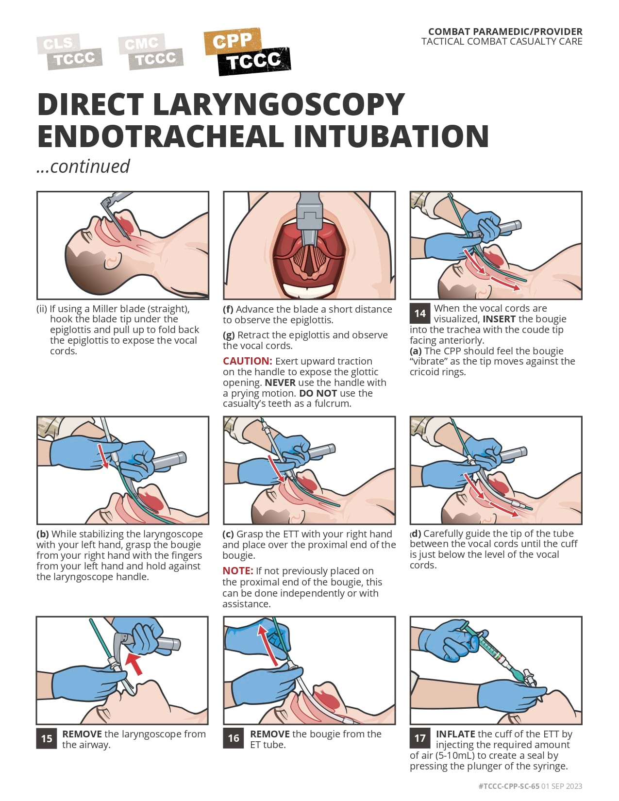 Direct Laryngoscopy Endotracheal Intubation (Bougie & ETT Tube Introducer)), cpp, page 3