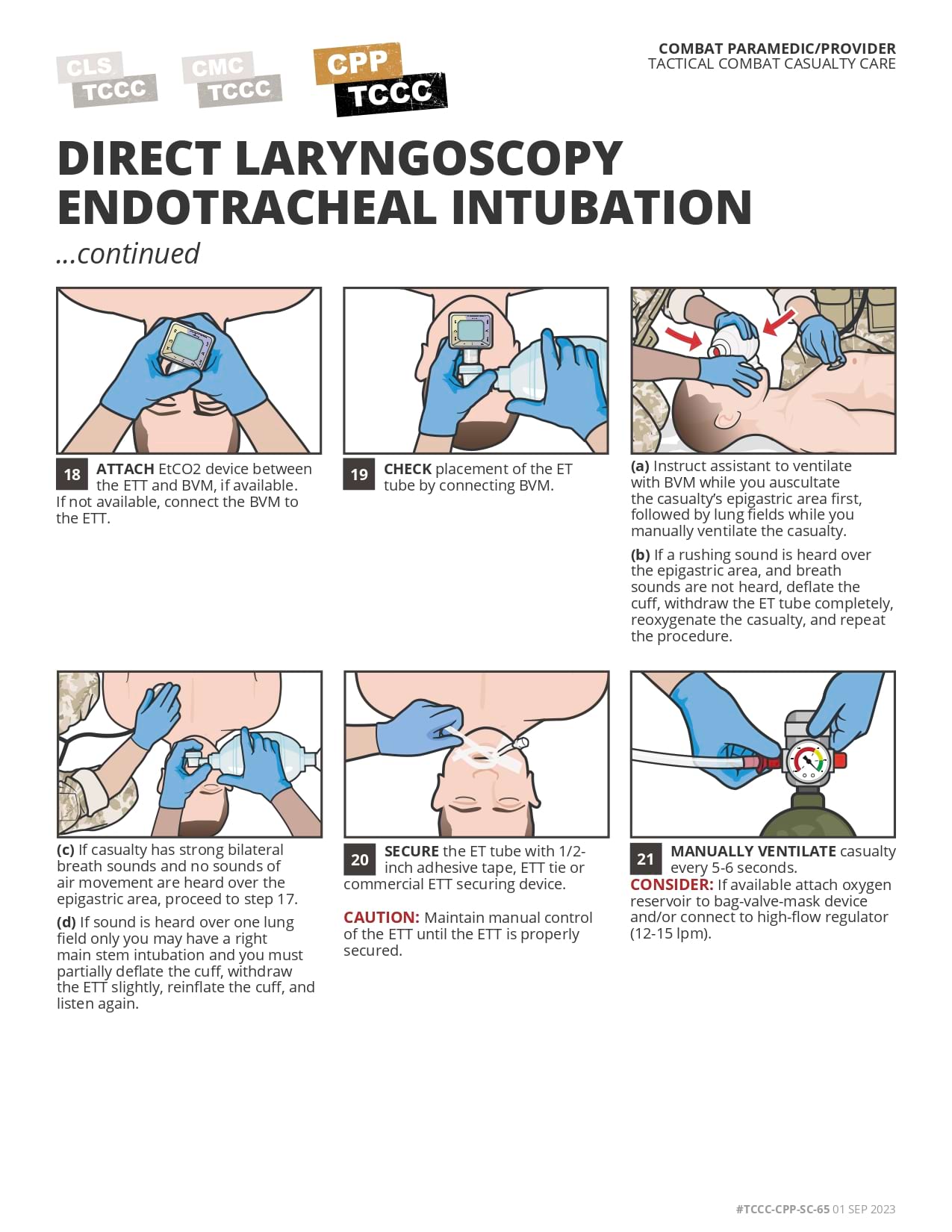 Direct Laryngoscopy Endotracheal Intubation (Bougie & ETT Tube Introducer)), cpp, page 4