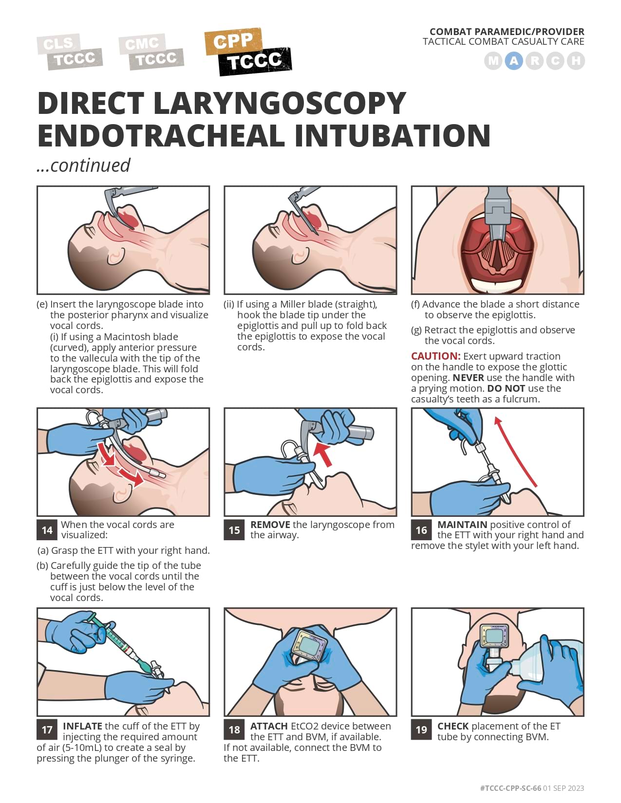 Direct Laryngoscopy Endotracheal Intubation (Bougie & ETT Tube Introducer)), cpp, page 8